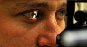 Cataract Scanning at Opticians
