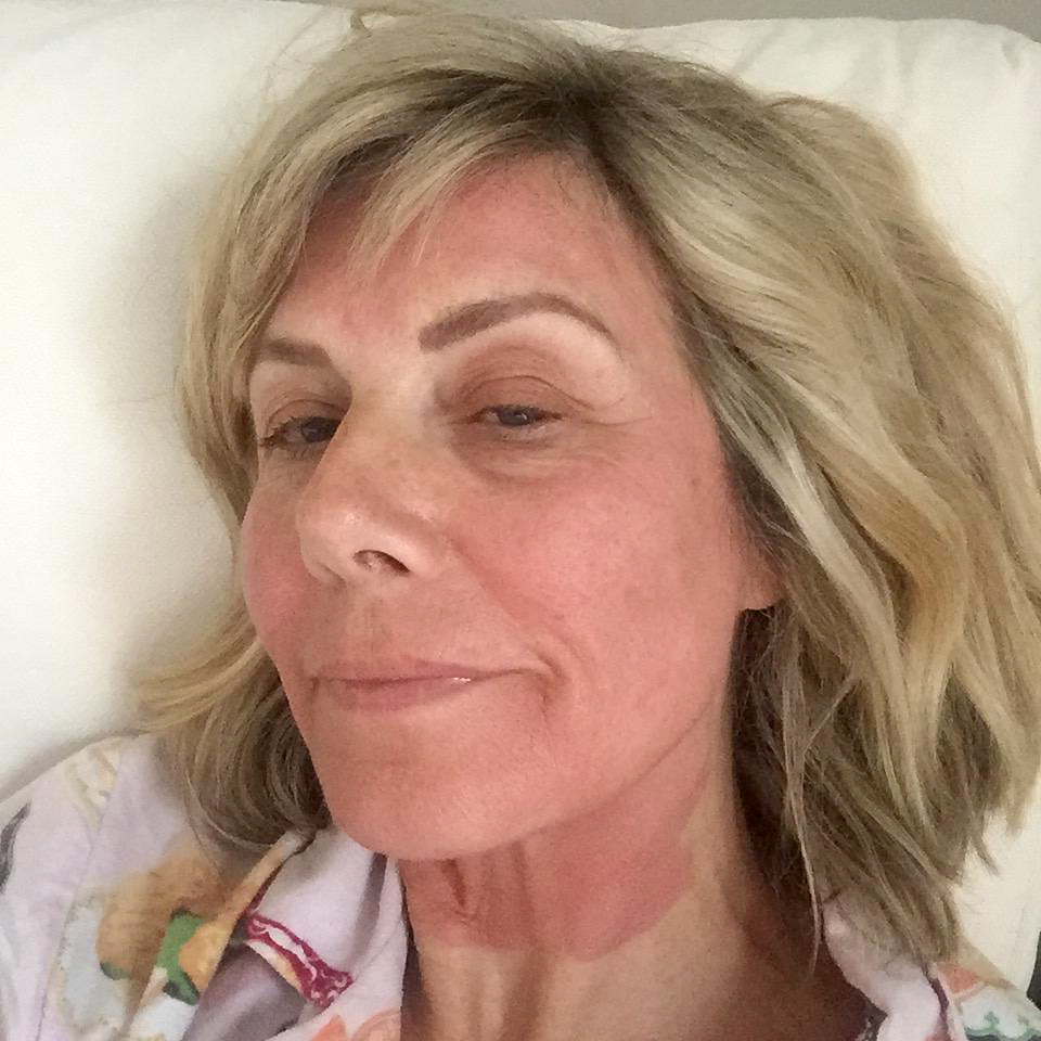 Glynis Facial Rejuvenation Treatment