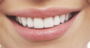 Good Oral Health Smile