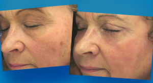 Harley Street Skin Clinic Before and After Banner