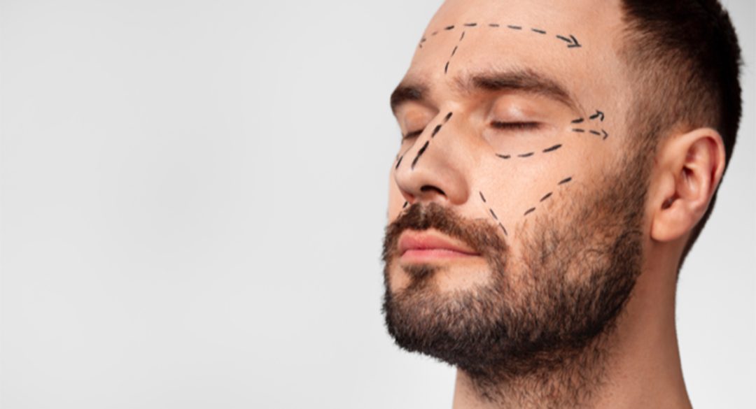 Bearded man with tweakment markings