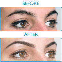 HD Brows - Before and After